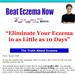 Beat Eczema - 3 Backend Offers